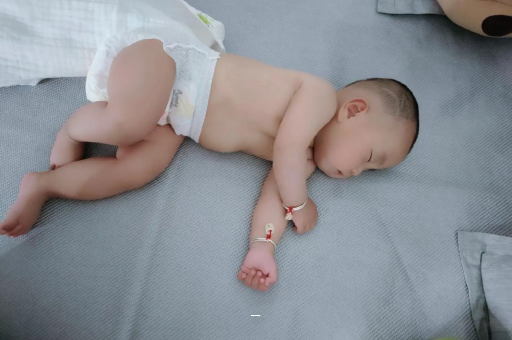 长沙宝宝脸上有白色斑块